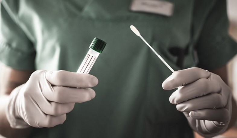 Teste de Covid PCR é obrigatório para embarcar ao Brasil